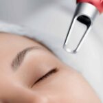 Picosure Laser: What You Should Know Before You Go